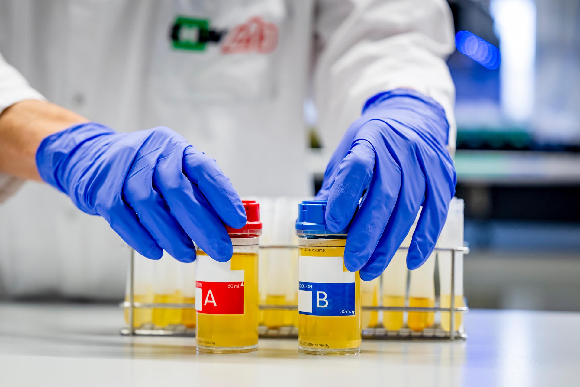 Un collaborateur du LAD, le Laboratoire suisse d'Analyse du Dopage, analyse des echantillons A et B contenant de l'urine dans le laboratoire antidopage,